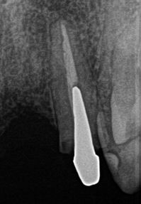 2012.10.11 3R78.jpg